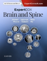 ExpertDDx: Brain and Spine - Jhaveri, Miral D.; Salzman, Karen L.; Ross, Jeffrey S.; Moore, Kevin R.; Osborn, Anne G.; Ho, Chang Yueh