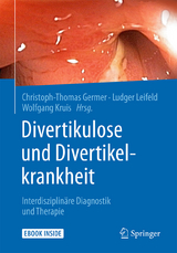 Divertikulose und Divertikelkrankheit - 