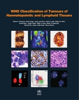 WHO classification of tumours of haematopoietic and lymphoid tissues - International Agency for Research on Cancer; Swerdlow, S.H.