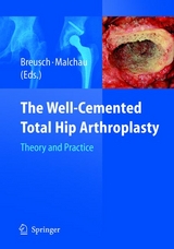 The Well-Cemented Total Hip Arthroplasty - 