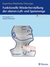 Funktionelle Wiederherstellung der oberen Luft- und Speisewege - 