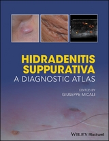 Hidradenitis Suppurativa - 