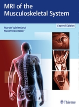 MRI of the Musculoskeletal System - Vahlensieck, Martin; Reiser, Maximilian