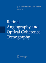 Retinal Angiography and Optical Coherence Tomography - 