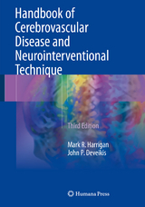 Handbook of Cerebrovascular Disease and Neurointerventional Technique - Harrigan, Mark R.; Deveikis, John P.