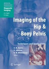 Imaging of the Hip & Bony Pelvis - 