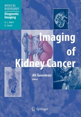 Imaging of Kidney Cancer - 