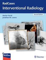 Radcases Interventional Radiology - Ferral, Hector; Lorenz, Jonathan M.