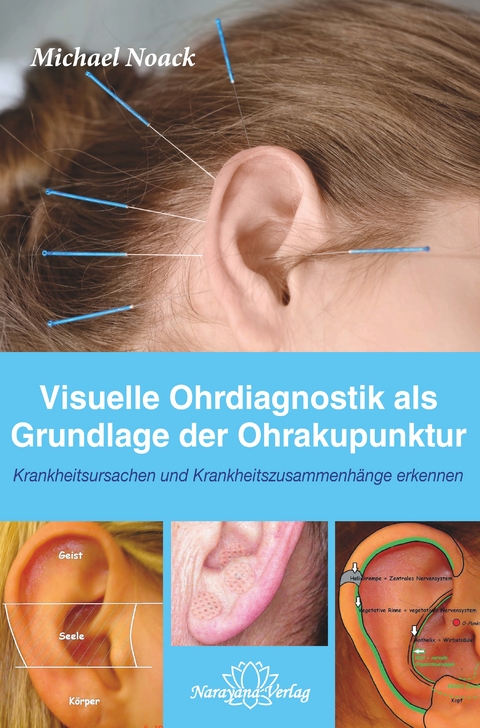 Visuelle Ohrdiagnostik als Grundlage der Ohrakupunktur - Michael Noack
