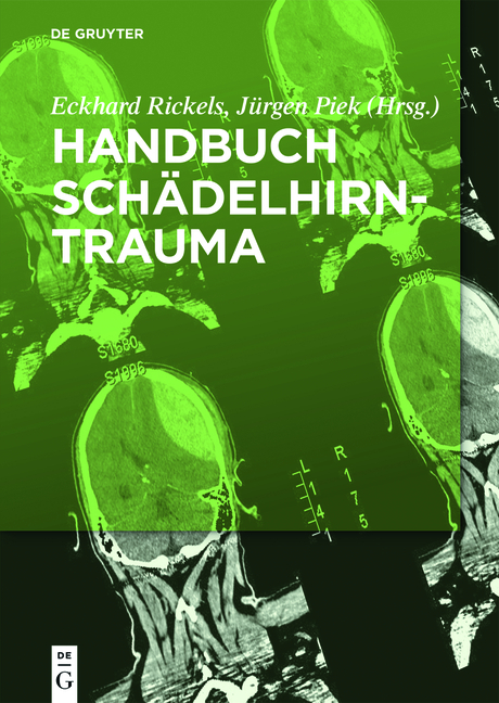 Handbuch Schädel-Hirn-Trauma - 