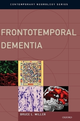 Frontotemporal Dementia - Bruce L. Miller