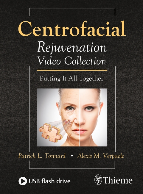 Centrofacial Rejuvenation Video Collection, 1 DVD - Patrick Tonnard, Alexis Verpaele