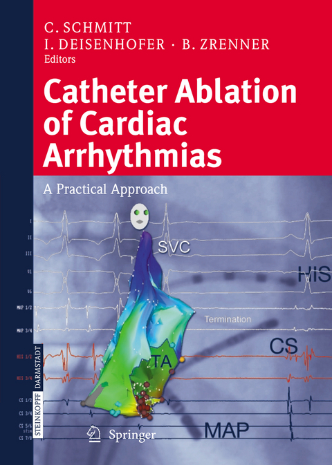 Catheter Ablation of Cardiac Arrhythmias - 