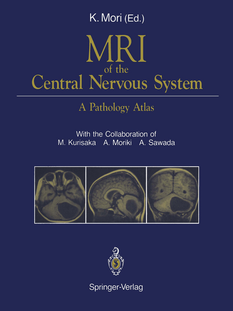 MRI of the Central Nervous System - 