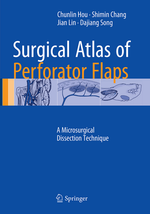 Surgical Atlas of Perforator Flaps - Chunlin Hou, Shimin Chang, Jian Lin, Dajiang Song