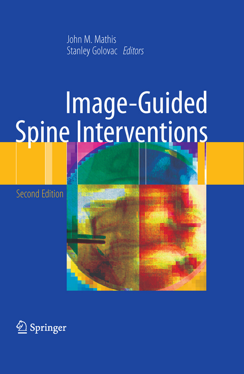 Image-Guided Spine Interventions - 