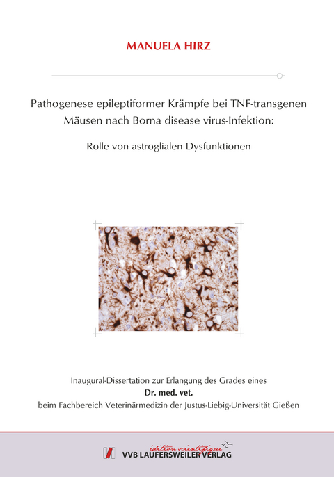 Pathogenese epileptiformer Krämpfe bei TNF-transgenen Mäusen nach Borna disease virus-Infektion: - Manuela Hirz