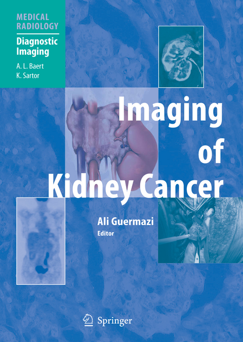 Imaging of Kidney Cancer - 