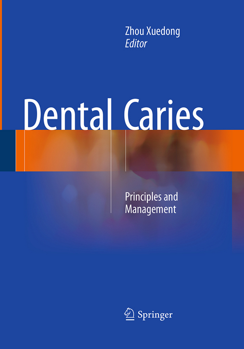 Dental Caries - 