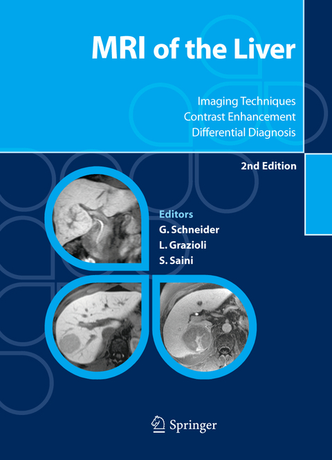 MRI of the Liver - 