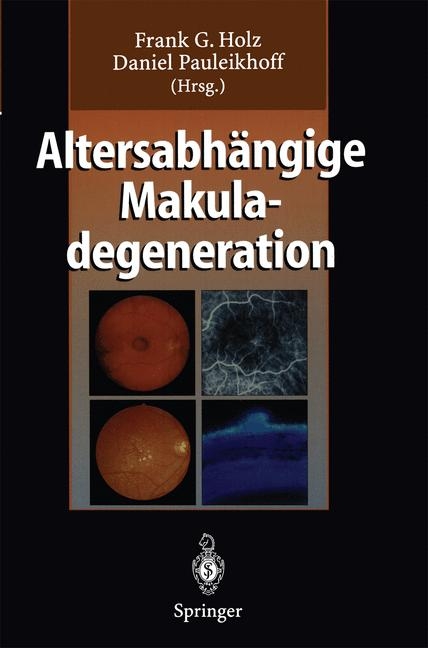 Altersabhängige Makuladegeneration - 