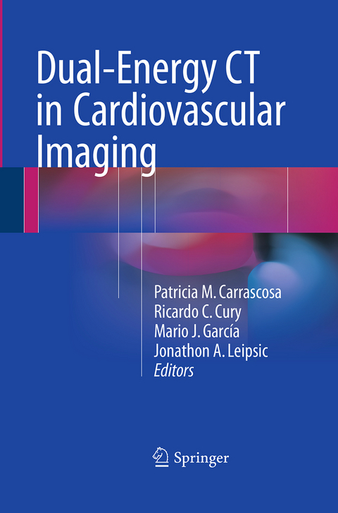 Dual-Energy CT in Cardiovascular Imaging - 