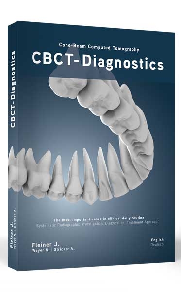 CBCT-Diagnostics - Jonathan Fleiner, Nils Weyer, Andres Stricker