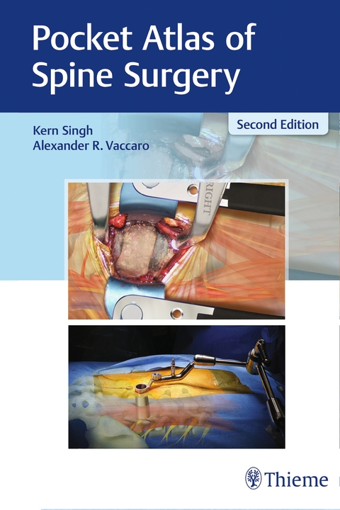 Pocket Atlas of Spine Surgery - Kern Singh, Alexander R. Vaccaro