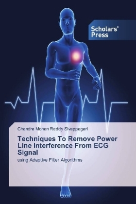 Techniques To Remove Power Line Interference From ECG Signal - Chandra Mohan Reddy Sivappagari