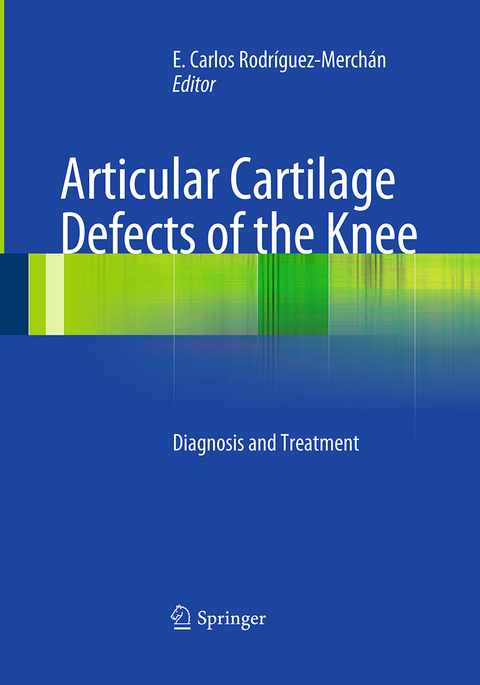 Articular Cartilage Defects of the Knee - 