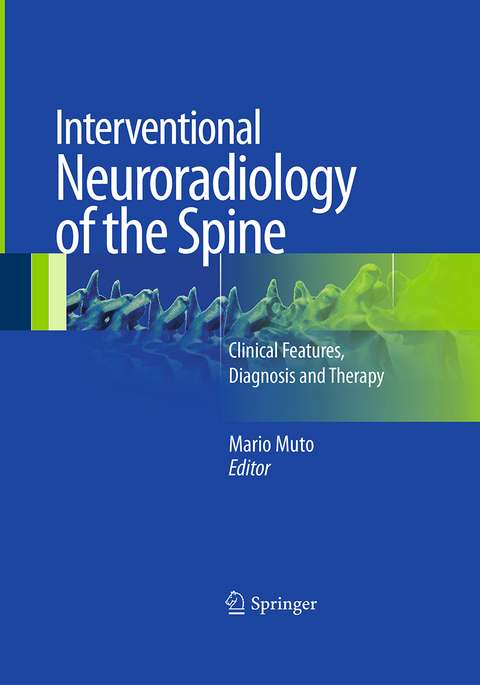 Interventional Neuroradiology of the Spine - 