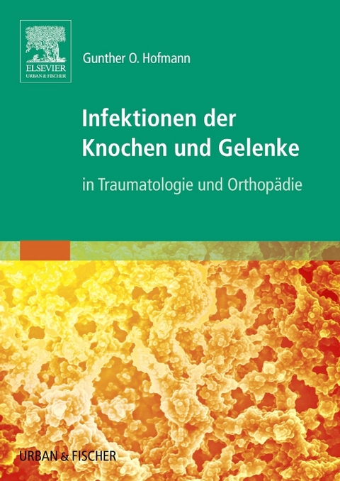 Infektionen der Knochen und Gelenke - Gunther O. Hofmann