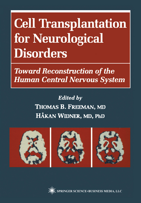 Cell Transplantation for Neurological Disorders - 