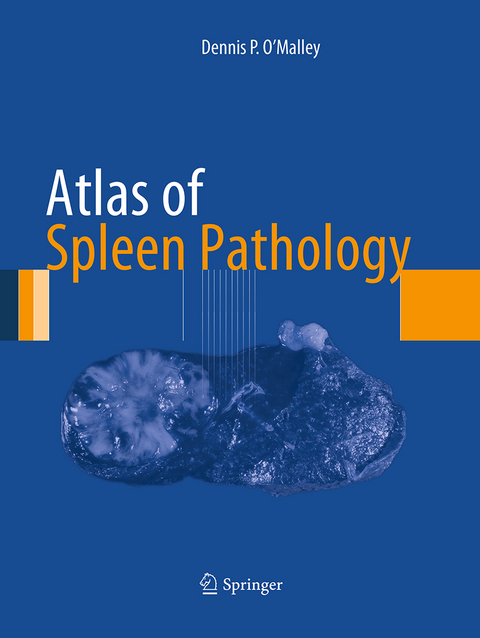 Atlas of Spleen Pathology - Dennis P. O'Malley