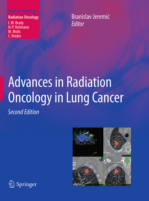 Advances in Radiation Oncology in Lung Cancer - 
