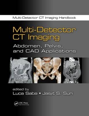 Multi-Detector CT Imaging - 
