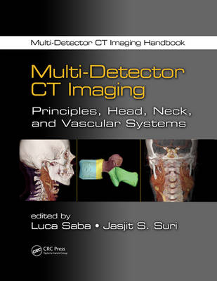 Multi-Detector CT Imaging - 