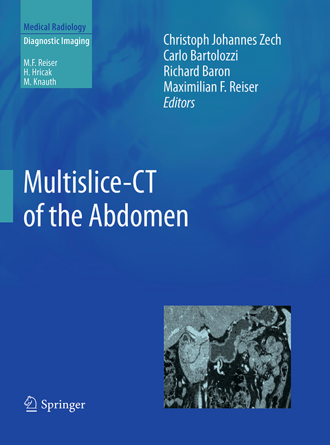 Multislice-CT of the Abdomen - 