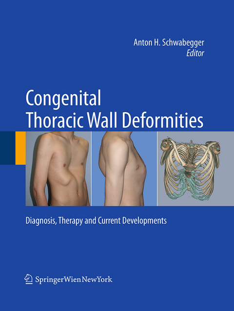 Congenital Thoracic Wall Deformities - 
