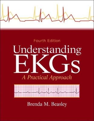 Understanding EKGs - Brenda Beasley