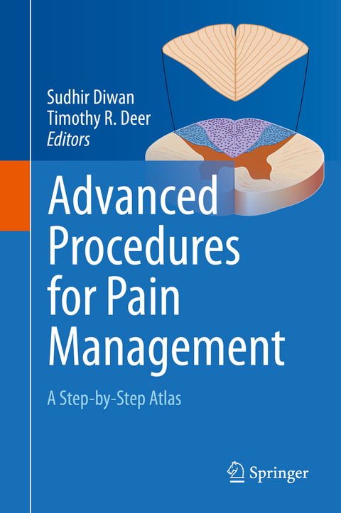 Advanced Procedures for Pain Management - 