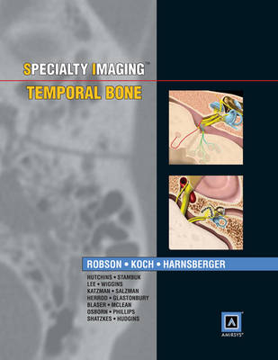 Specialty Imaging: Temporal Bone - Caroline D. Robson, Bernadette L. Koch, H. Ric Harnsberger