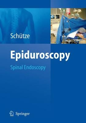 Epiduroscopy - Günter Schütze