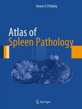 Atlas of Spleen Pathology -  Dennis P. O'Malley