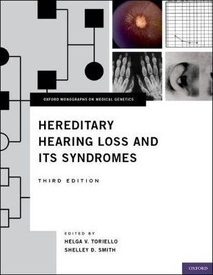 Hereditary Hearing Loss and Its Syndromes - 