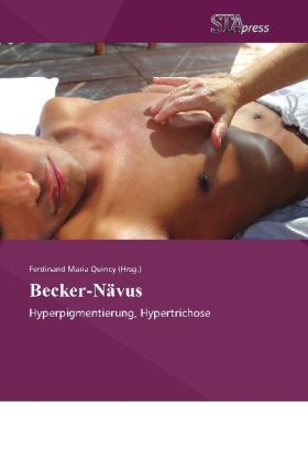 Becker-Navus