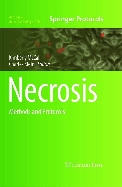 Necrosis - 