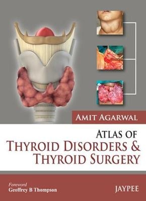 Atlas of Thyroid Disorders and Thyroid Surgery - Amit Agarwal