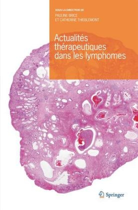 Actualités Thérapeutiques Dans Les Lymphomes - 