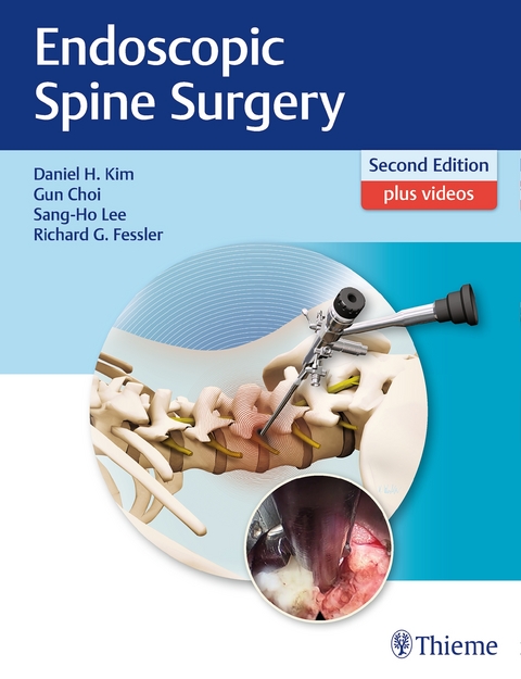 Endoscopic Spine Surgery - 